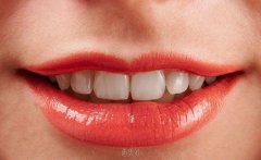 牙齿整形有几种方法？烤瓷牙、隐形矫正、纳米陶瓷贴面… width=