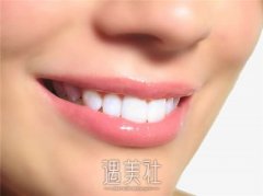 德国费亚丹Friadent种植体的优缺点解析分享 width=