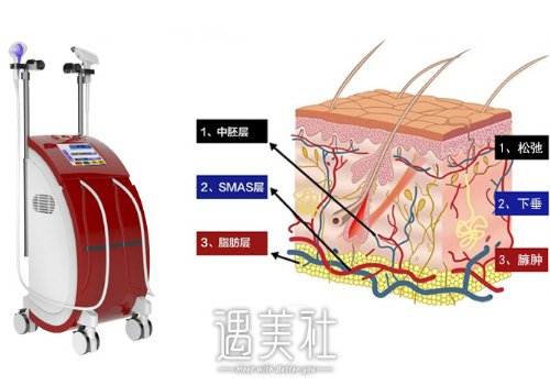 黄金热拉提和热拉提plus的区别大吗？各自的优势有哪些？ width=