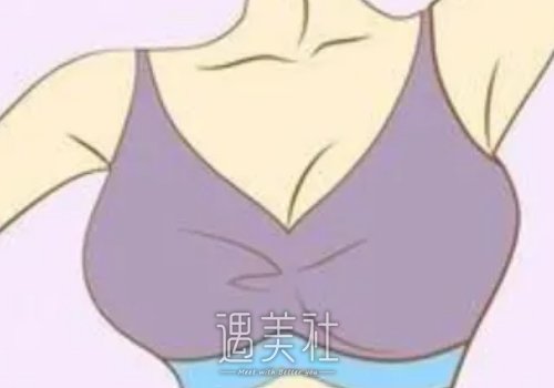 胸下垂怎样提升？方法都有哪些？ width=