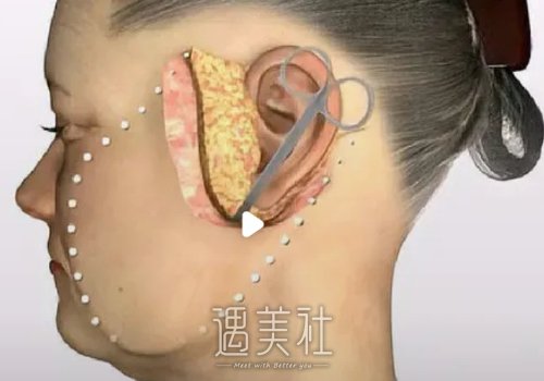 双燕尾拉皮跟小拉皮有什么区别？各自优势有哪些？ width=