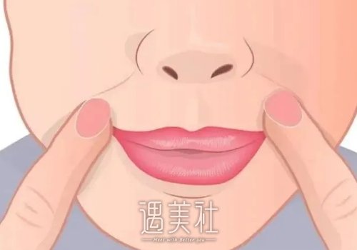 筋膜悬吊面部提升有风险吗？效果能维持多久？ width=