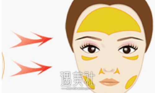 7d聚拉提多久做一次？术后注意事项有哪些？ width=