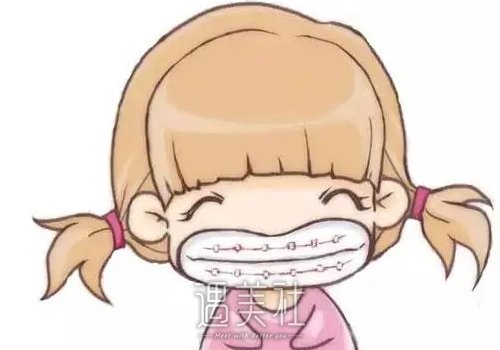 自锁托槽矫正多少钱？项目优势有哪些？ width=