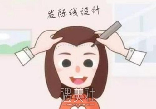 蛋白纤维植发效果怎么样？有危害吗？ width=