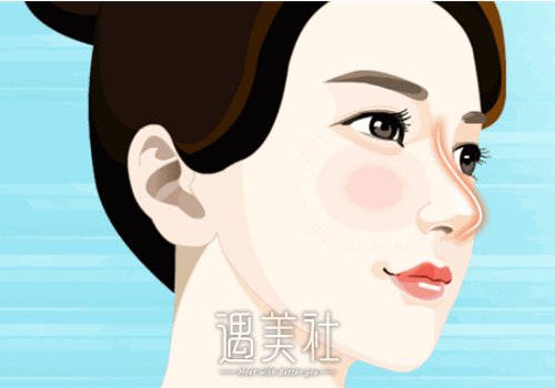 鼻中隔隆鼻是永久的吗？有什么后遗症？ width=