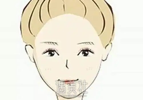 微笑唇整形多少钱？维持时间长吗？ width=