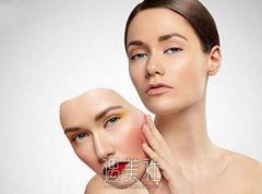 颧骨和颧弓位置图片|颧骨磨骨手术恢复多久？ width=