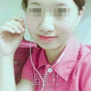 打瘦脸失败修复图片案例，脸型重新变得美观起来 width=