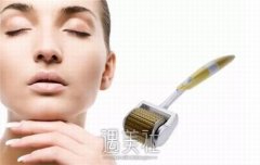 脱发微针多久做一次？微针生发原理是什么？ width=