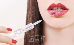 什么是理想的美唇标准？了解这些唇部整形技术！ width=
