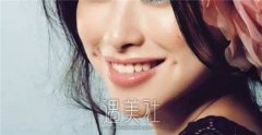 鼻尖突出度如何影响面部美感？好看的鼻尖究竟应该是怎样的呢？ width=