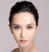 眼部肿胀能否做双眼皮？肿眼泡的成因及改善方法解答！ width=