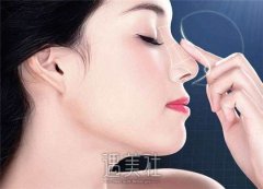 武汉地区鼻小柱短宽矫正术详细介绍，手术项目价格一览！ width=