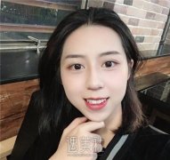 抚州绿飞秒眼科医院权威排名发布，附详细价格表速览 width=