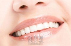 长沙望城区做牙冠推荐口腔医院汇总，牙冠价格表供您参考 width=