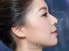太原内眼角修复与眶隔释放手术价格一览，专业医美指南 width=