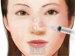 温州市嘴角上扬术机构推荐：唯美、艾美时光哪家更胜一筹 width=