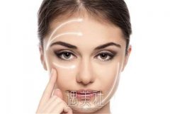 绍兴颧弓降低医美如何选择？专业医院推荐分享 width=