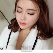 石家庄专业臀部疤痕修复服务费用详细介绍，了解疤痕修复收费标准 width=