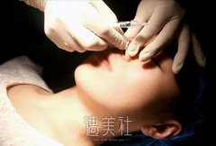 江苏常州颧骨内推价格表揭晓！这些医美机构报价贵吗？ width=