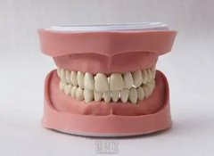昆明牙齿矫正价格表分享：十大口腔医院(艺博、昆德、亲亲等)费用一览 width=
