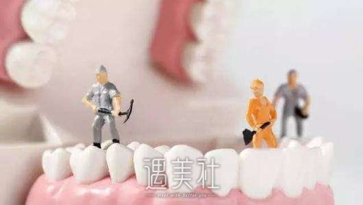 洗牙