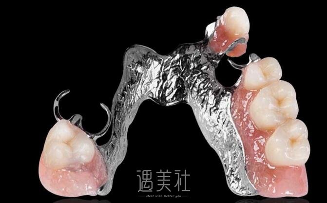 活动义齿