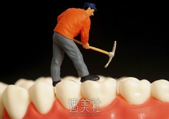 镶牙