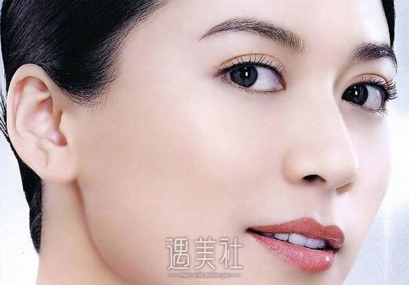 全切双眼皮